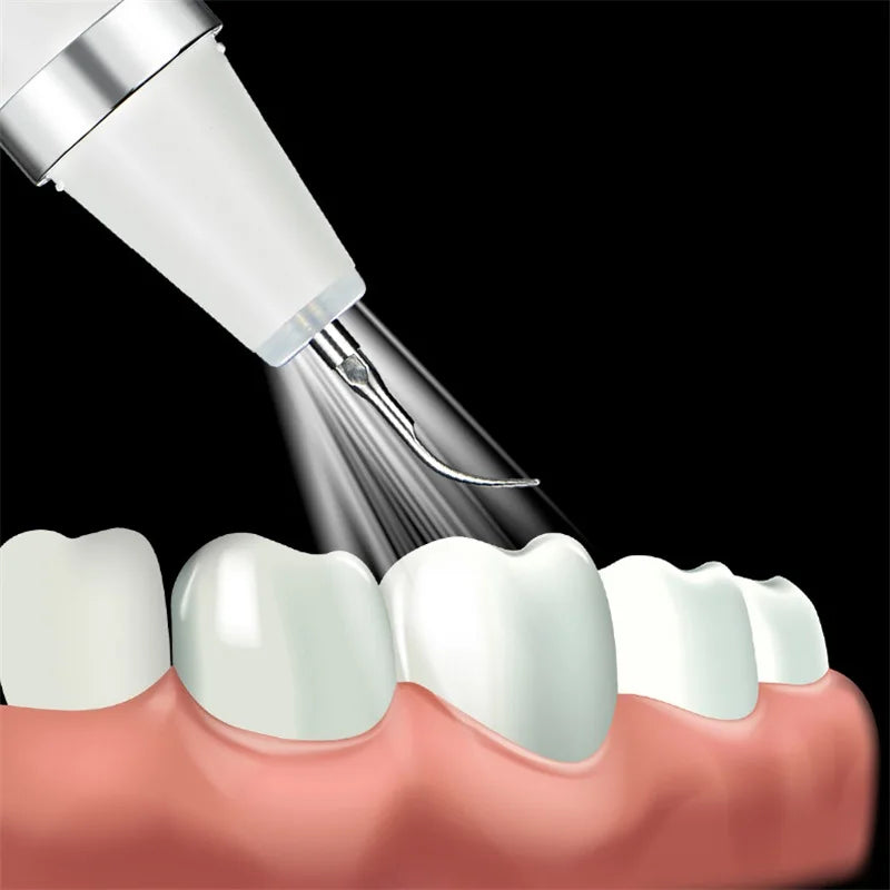 Dog Ultrasonic Dental Scaler - vuliza